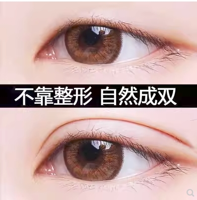 北京协和医院黄久佐做双眼皮怎么样?口碑医生介绍,双眼皮案例欣赏!