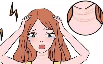 为什么会出现颈纹？颈纹是如何出现的可以来参考