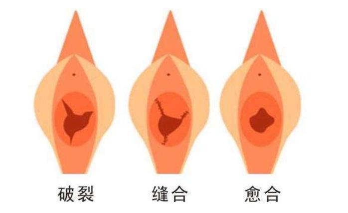 八大处整形医院李峰永主任怎么样?私密整形医生实力测评!近期案例反馈