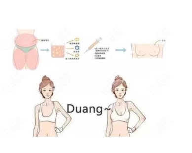 北京八大处刘春军做自体脂肪隆胸多少钱?北京美胸大咖实力揭秘,必看!