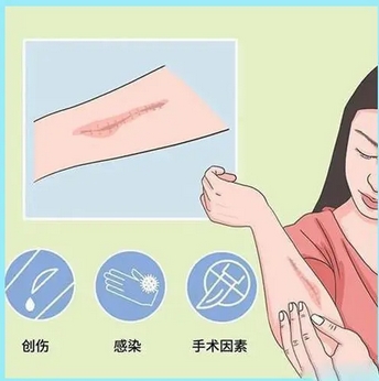 谭军医生调节疤痕好吗？技术口碑如何？妙手成就无疤痕！