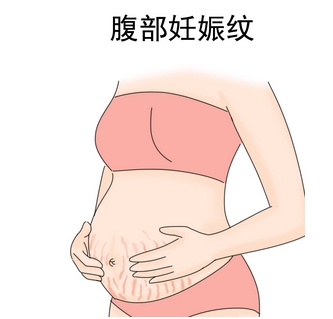 祛妊娠纹产品排行榜公布!好用的妊娠霜/油都在这里!你pick哪一款~