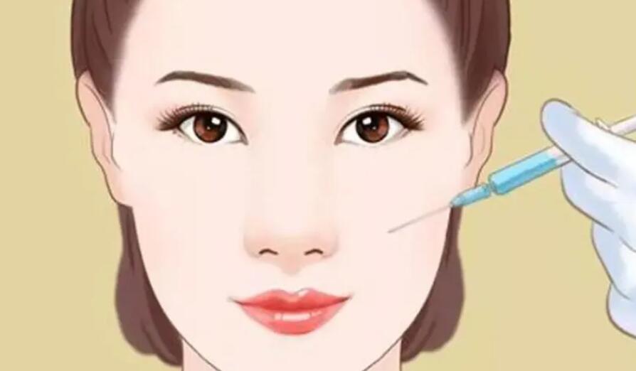 苹果肌复位术怎么做?费用贵不贵?注意事项超全盘点!