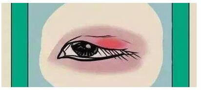 西京医院崔江波怎么样？做什么双眼皮风格多？样子怎么样？附真实案例