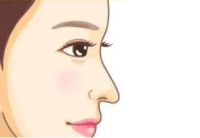 北京世纪坛医院整形外科怎么样？医生哪个好？附双眼皮案例_价格表