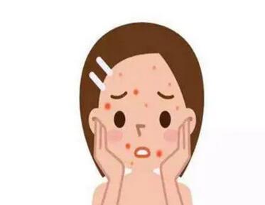 彩光嫩肤祛痘的原理是什么?彩光嫩肤为祛痘首选妙招!