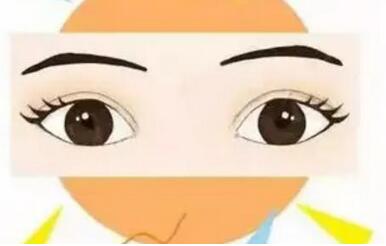 内双可以割双眼皮吗?收获美丽的双眼皮!术后注意事项看这里!