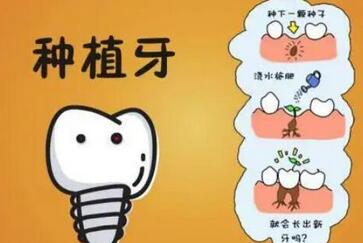 上海种植牙价格表一览!有具体的分享啦!