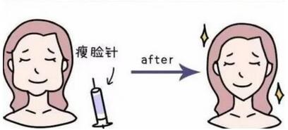 注射瘦脸一周果图曝光！分享打注射瘦脸的过程和效果！