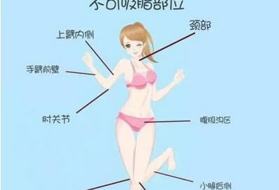 有什么有的减肥方法你知道哪些？饮食控制、吸脂、激光溶脂可以尝试！