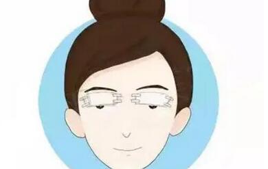 孙家明双眼皮技术怎么样?医生简介_双眼皮真实案例果,美眼很好!