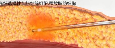 简单快速的减肥方法有哪些？让你想不瘦都难！