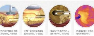 简单快速的减肥方法有哪些？让你想不瘦都难！