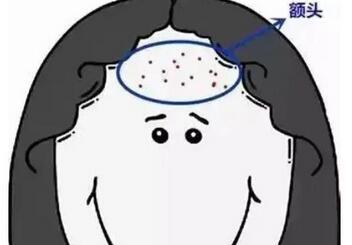 额头长了很多密密麻麻的小痘痘是什么原因？原因科普-改良方法