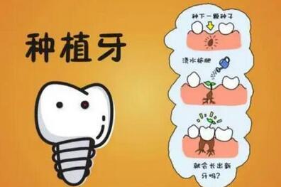 上海种植牙收费价目表大约是多少?收费标准怎么样?附种植牙价目表