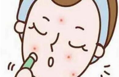 十滴水和甲硝唑凝胶能祛痘是真的吗？如何避免长痘！