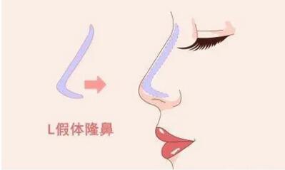 医学科学院美容整形外科医院有开展哪些项目？内附医生介绍！