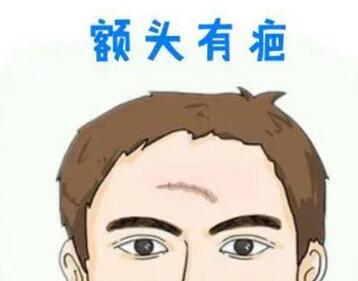 北京301医院疤痕科激光技术如何？内附徐军_韩岩医生详细简介！