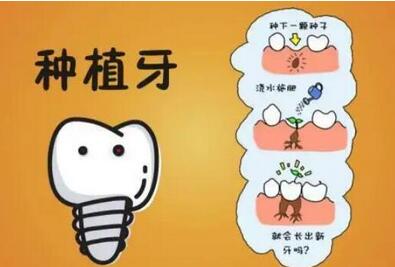 良心医生不建议种植牙？分享种牙的优缺点！