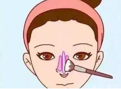 北京协和整形外科哪个医生技术好？分享隆鼻手术全过程！