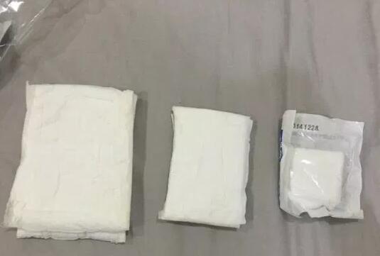 手臂抽脂后多久可以做塑形运动？2点注意事项汇总！