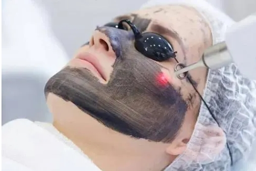黑脸娃娃谁做过？黑脸娃娃的优势是什么呢？会不会有疼痛感？由黑变白的蜕变~