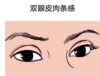 苏薇洁修复双眼皮厉害还是余东？个人资料|口碑在线一览！近期测评~