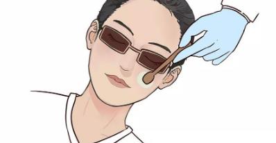 光子嫩肤适合多大年龄,如何正确的选择?