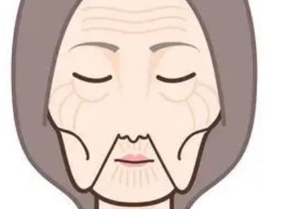 面部拉皮除皱整形好吗?如何正确的选择?