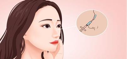 胶原蛋白隆鼻好吗？具有哪些优势？如何进行隆鼻？