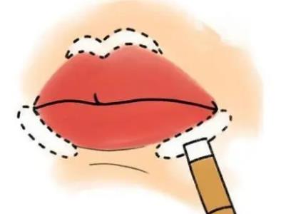 丰唇手术后遗症有哪些？包括出xue，血肿，外形不佳等！