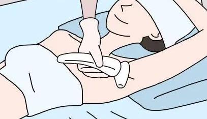 激光脱毛大概多少钱?受到哪些影响? 必了解清单参考!