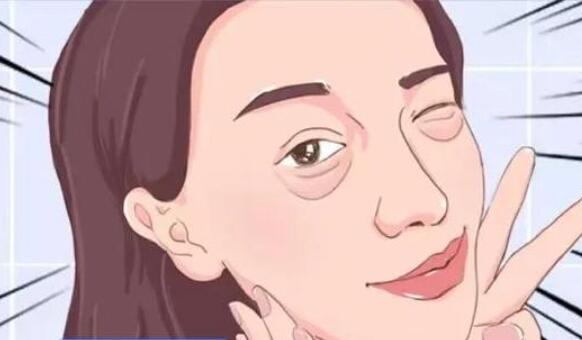 山东做手术去眼袋要花多少钱?哪些因素影响价格的变动?