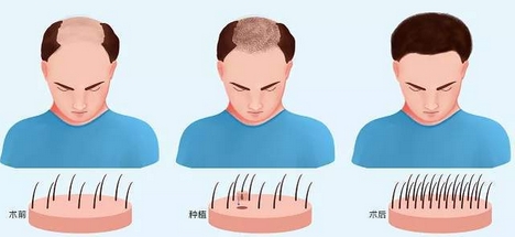 南京鼓楼美莱医疗美容门诊部植发怎么样?医生怎么样?超全资料公开!