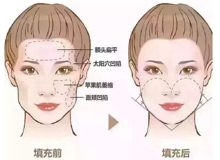 广大医院整形美容好不好？口碑好不好,何锦泉、王政医生怎么样？