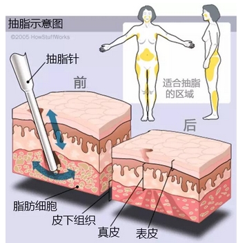 上海长征医院朱䴕割双眼皮怎么样?本院医生信息介绍、擅长项目点评攻略~