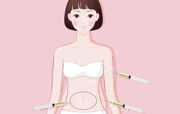 顾云鹏腰腹环吸价格贵不贵？医生实力点_真人吸脂案例展示！
