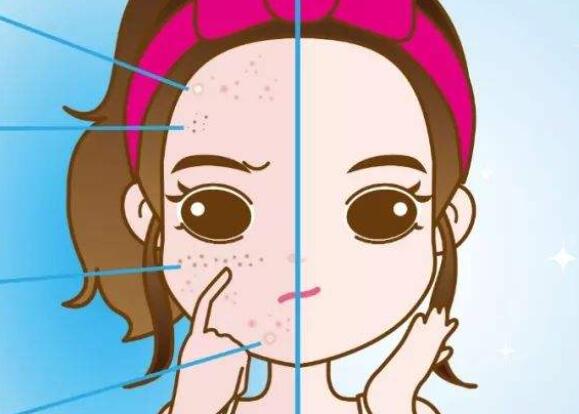 去除黄褐斑的方法有哪些？日常生活中怎么护理自己的皮肤？