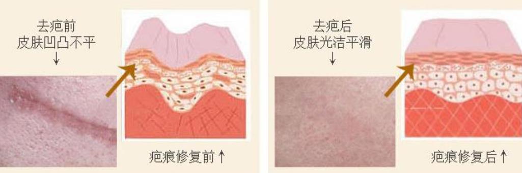 山东省立医院张健医生痣切除怎么样？个人简介、经典案例分享！