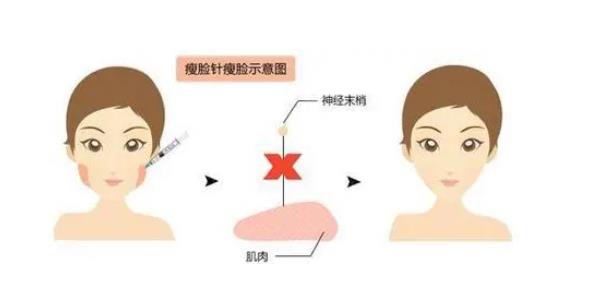 董肇杨打瘦脸吗？医生个人简介_坐诊医院_网友案例:v脸很流畅！