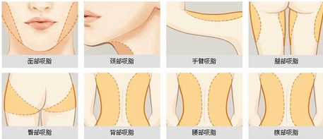 昆明美立方医疗美容医院怎么样？医院介绍_擅长项目有哪些？