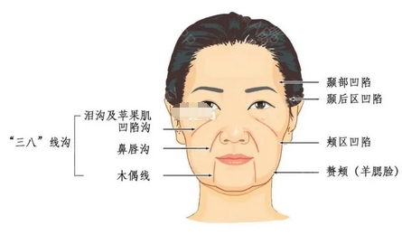 胡华新面部脂肪移植做的怎么样？坐诊医院介绍~面部脂肪移植求美评价！
