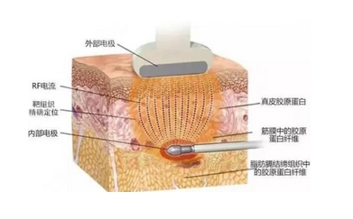 星面孔医疗美容门诊部怎么样？是正规整形医院吗？还有医生实力查收！