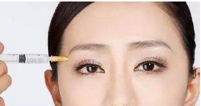 张冰洁修复眼袋怎么样？top1的张冰洁技艺卓群！修复案例怎么样？