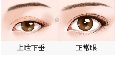 叶信海医生医术怎么样？人气整形医生技术揭秘，擅长项目反馈公开！