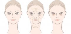 去除鱼尾纹用什么手术？如何护理自己的皮肤？戳进来看