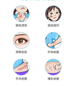 南宁廖明德疤痕修复怎么样？分享案例如何？修复痕迹重拾美丽！