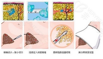 天津河东鑫伊颂医疗美容诊所怎么样？曹垒、王恩龙医生怎么样？附擅长科普知识~