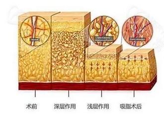 天津河东鑫伊颂医疗美容诊所怎么样？曹垒、王恩龙医生怎么样？附擅长科普知识~