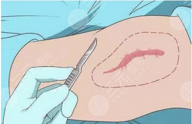 武汉江城整形外科医院怎么样？从资质和口碑来看很靠谱！附医生介绍~